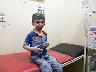 Syrian child waiting to be treated after an attack